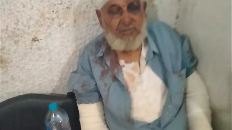استجابة لـ«بلدنا اليوم».. النيابة العامة تأمر بضبط وإحضار 19 شخصًا في واقعة الاعتداء على مسن ونجليه بكفر الشيخ