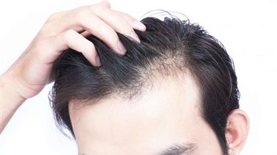 تعرف على الأطعمة التي تحارب تساقط الشعر