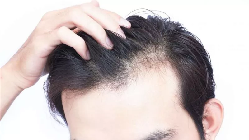 تعرف على الأطعمة التي تحارب تساقط الشعر