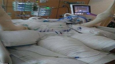 بالصور.. أمريكية تحرق نفسها تنفيذًا لتحدي النار