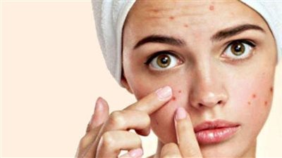 من بينها علاج حب الشباب وقشرة الشعر.. استخدامات مذهلة للأسبرين