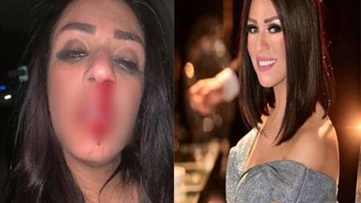 شاهيناز نجمة 