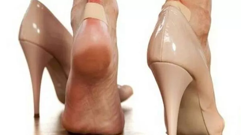 فكرة سريعة لتوسيع الحذاء الضيق في يوم واحد