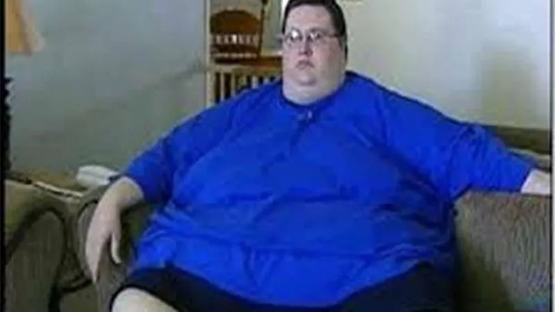 استشاري تجميل: 7 إرشادات ينبغي اتباعها بعد عمليات شفط الدهون
