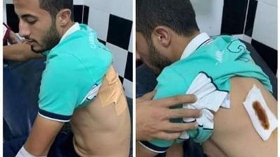 طعن نجم الوداد المغربي قبل مواجهة الترجي على يد مجهولين