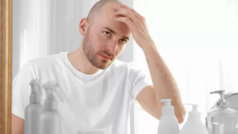انتبه.. عمليات زراعة الشعر قد تؤدى إلى الوفاة