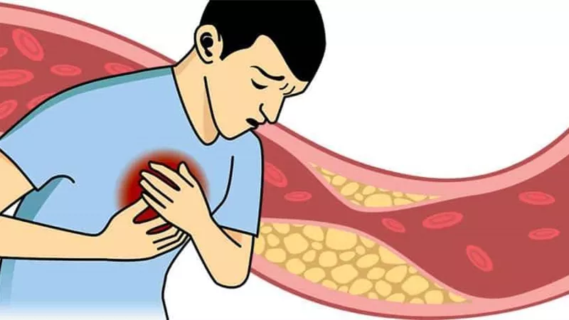 بدون عقاقير.. 5 طرق آمنه للتخلص من الكوليتسرول الضار
