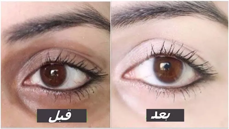 في 15 دقيقة..  تخلصي من الهالات السوداء بماء الورد