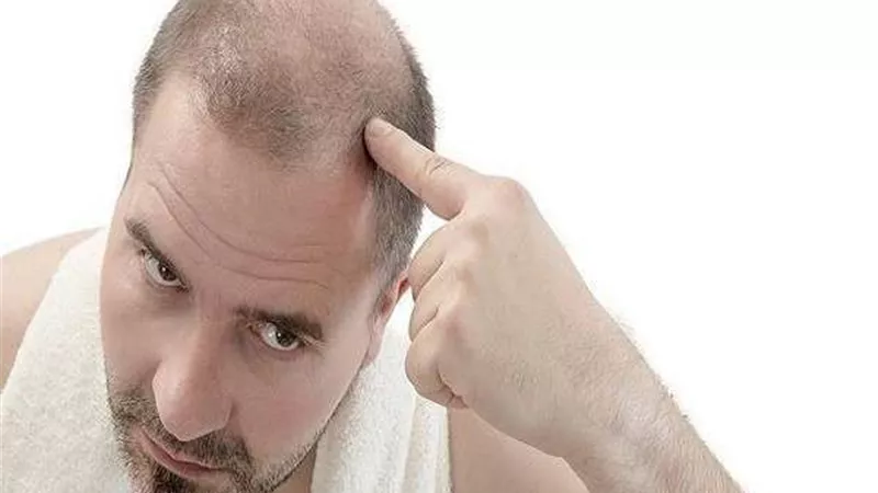 وداعاً لتساقط الشعر.. تعرف على أفصل الأطعمة الصحية لحمايته