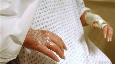 بسبب طبخة.. فتاة تسكب الزيت المغلي علي والدتها بالمنوفية
