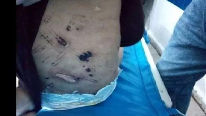 بالصور| من وصلة تعذيب حتى الوفاة.. القصة الكاملة للطفلة جنة 