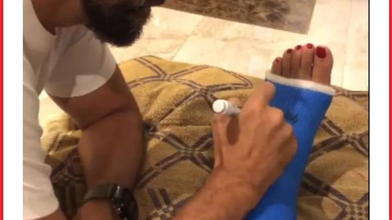 بطريقة كوميدية.. هشام ماجد يدعم زوجته بعد إصابتها بكسر