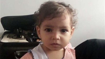 نجاح فريق طبي في إصلاح 