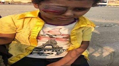 بعد هروب 