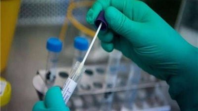 لجنة كورونا: لا يوجد بروتوكول محدد للعلاج من الفيروس