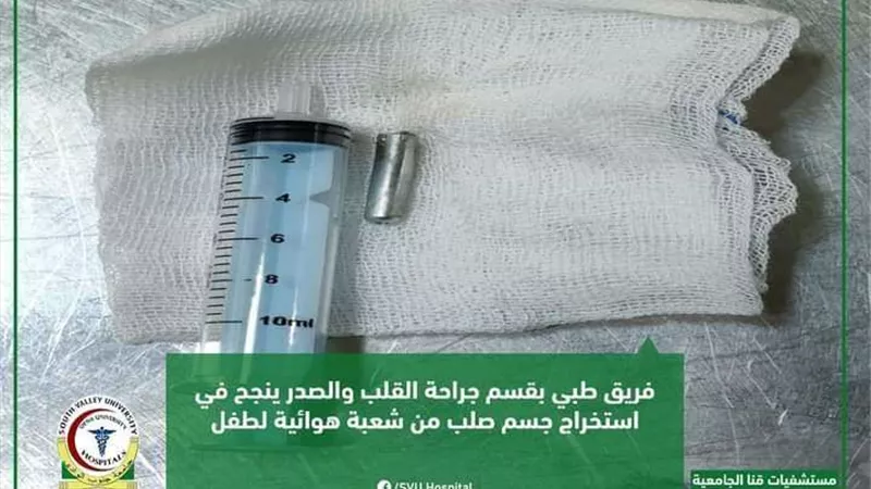 مستشفيات قنا الجامعية تساهم في انقاذ حياة طفلة استنشقت جسم غريب