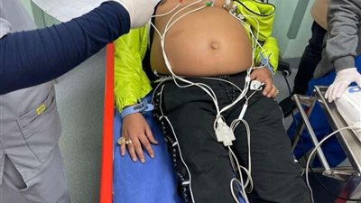 عاجل.. خروج حمو بيكا من المستشفى ومدير أعماله يكشف حقيقة خروجه