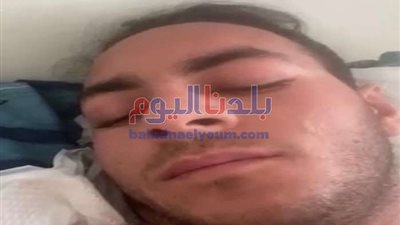 الخارجية: المصاب المصري بأوكرانيا تلقى طلقتين من طائرة هليكوبتر.. فيديو