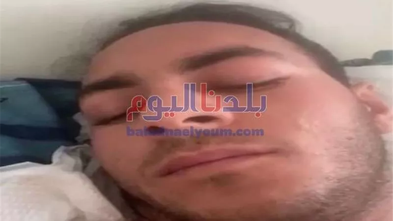 الخارجية: المصاب المصري بأوكرانيا تلقى طلقتين من طائرة هليكوبتر.. فيديو
