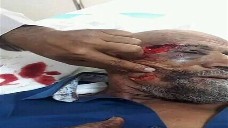 بالصور.. مسن يتعارك مع ذئب بري ويقتله خنقًا