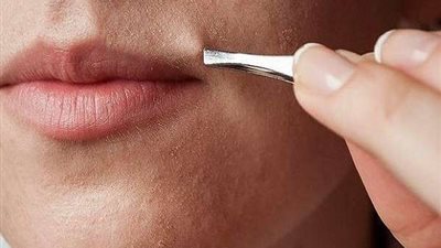 احذري.. نمو الشعر في الوجه يكشف عن مشكلة خطيرة