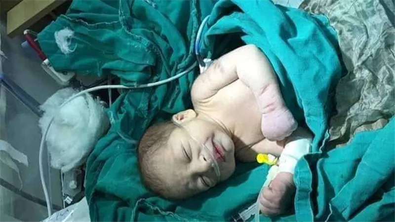 مفاجأة.. الرضاعة تحمي من فيروس كورونا
