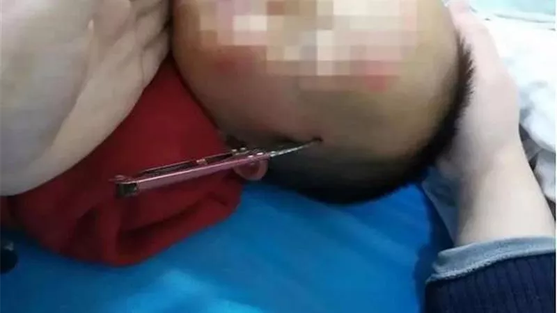 حكاية طفل كاد أن يفقد حياته بسبب والدته (صور)