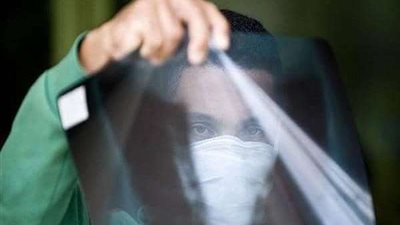 عالم أوبئة: التأخر في الذهاب إلى مستشفي العزل يقلل نسبة الشفاء
