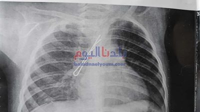 استخراج 