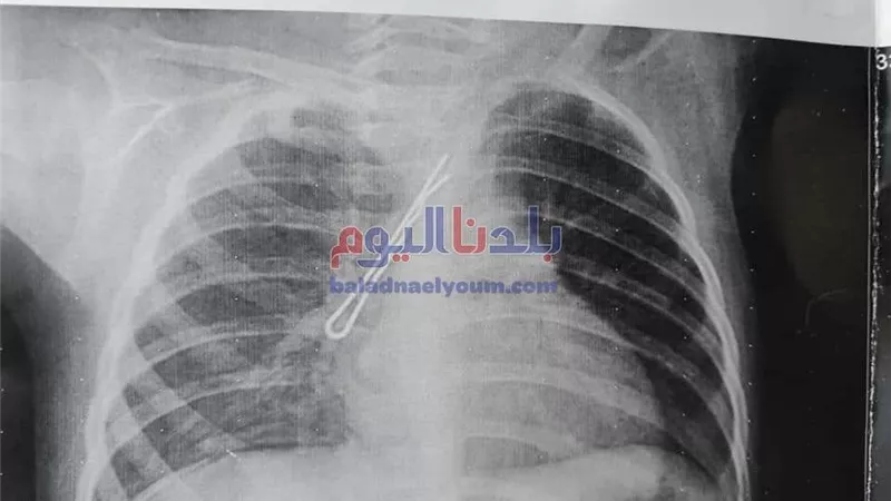 استخراج 