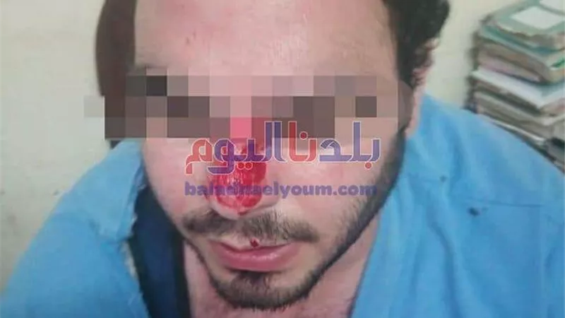 الاعتداء على طبيب أثناء تأدية مهام عمله بمستشفى جامعة طنطا
