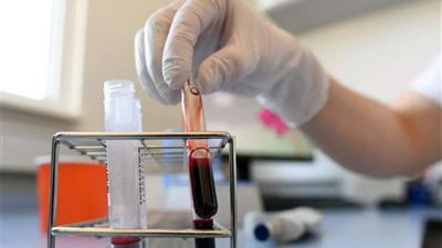 المصل واللقاح: جميع فصائل الدم مُعرضة للإصابة بفيروس كورونا