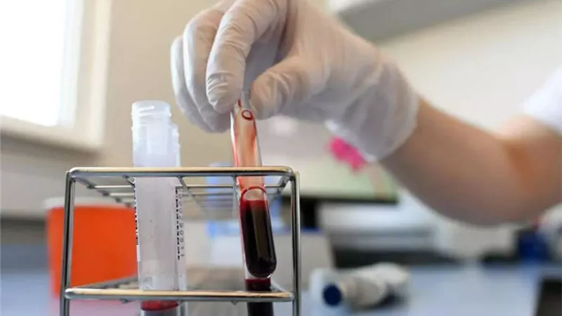 المصل واللقاح: جميع فصائل الدم مُعرضة للإصابة بفيروس كورونا