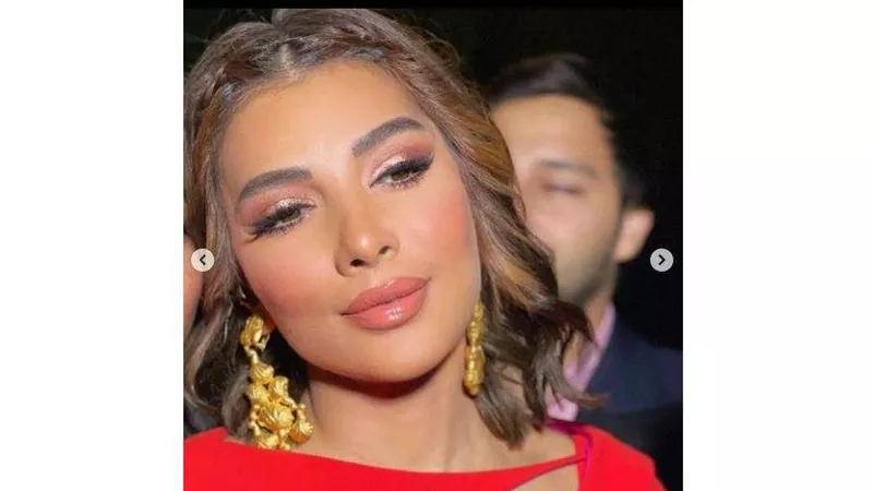 صور| شكلها اتغير خالص.. أصالة تثير جدلا بعد عمليات التجميل