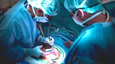 محامٍ يوضع عقوبة نقل الأعضاء بالمخالفة للقانون .. فيديو