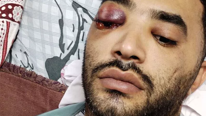 وفاة عريس الغربية بعد تهشيم راسه بشاكوش بسبب الغيرة .. تفاصيل