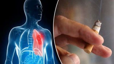 دراسة توضح العلاقة بين التدخين وفيروس كورونا