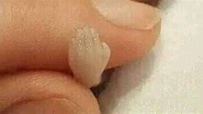 خلال جلسة تصوير .. امرأة تثير السوشيال ميديا بعد اجهاض طفلها