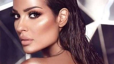 حقيقة تشوه وجه نادين نجيم في انفجار بيروت.. صور