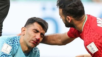كأس العالم.. أولى إصابات المونديال في صفوف إيران