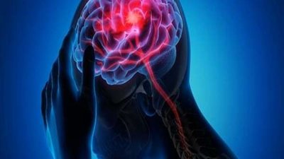 بالفيديو.. لهذا السبب أصبحت الجلطات ثالث سبب للوفاة في مصر