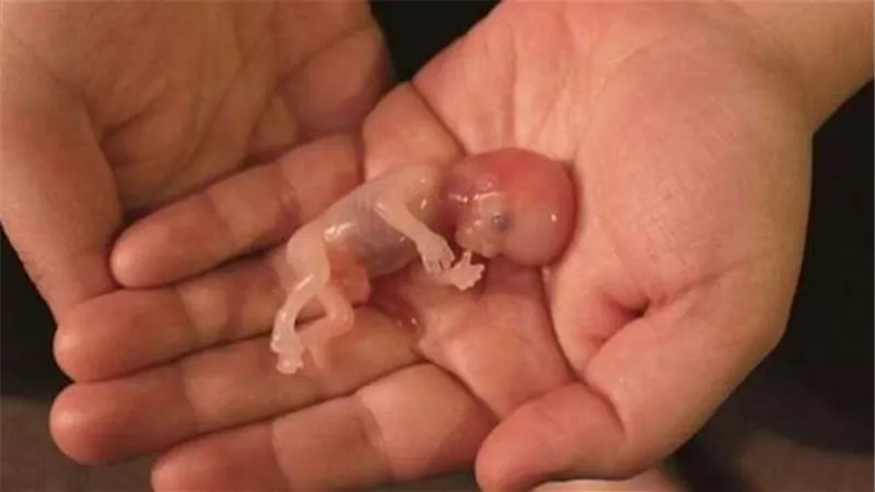 فرنسا تصوت لصالح قرار يكرس حق الإجهاض في الدستور