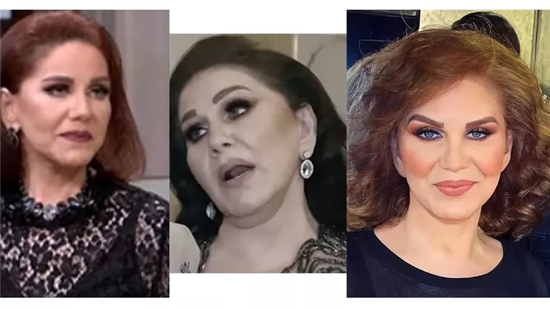 ما سر صورة ميادة الحناوي؟ خبير يوضح عمليات التجميل التي أعادتها شبابا