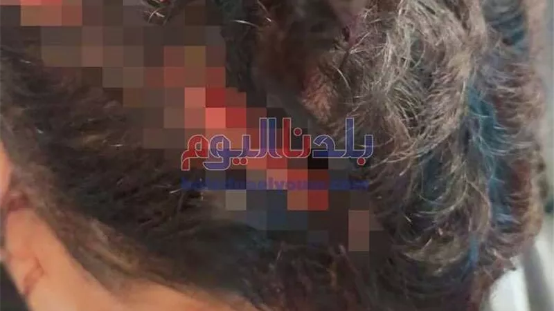 حبس المتهمين بالاعتداء على شاب وسرقته فى المحلة