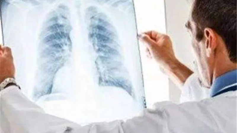 استشاري أمراض صدرية: الصعوبة في التنفس من أعراض الالتهاب الرئوي الخطير