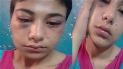 محاكمة مازن وشيماء في قضية فتاة 
