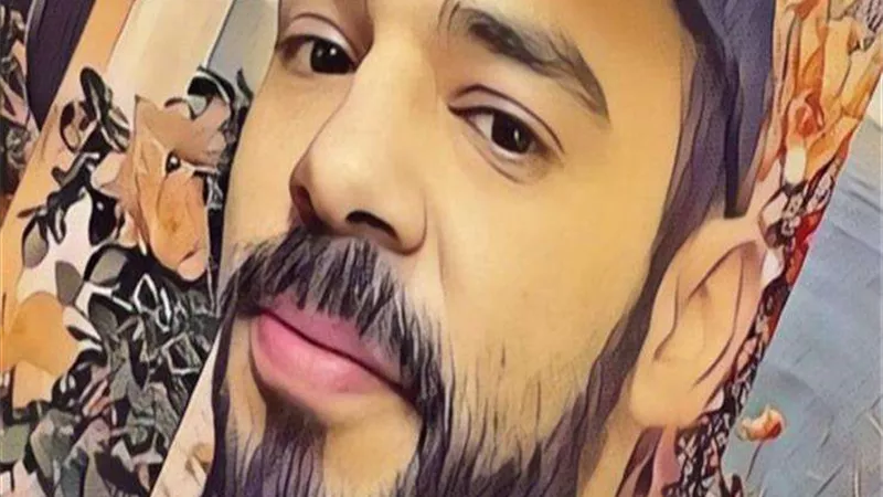 الشاعر الغنائي محمد أبو نعمة يجري عملية قسطرة بالقلب وتركيب دعامة