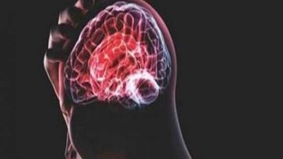 مرض لا دواء له.. علماء يكتشفون جزيئات نووية فى أدمغة الشباب