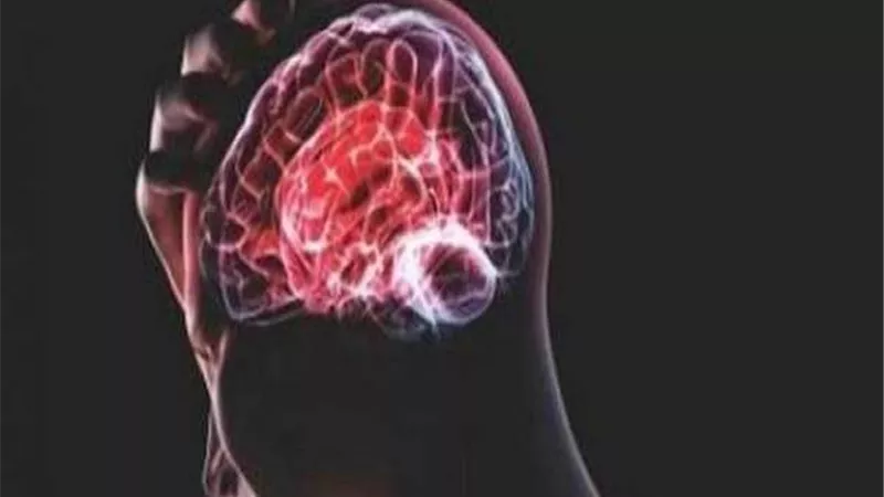 مرض لا دواء له.. علماء يكتشفون جزيئات نووية فى أدمغة الشباب