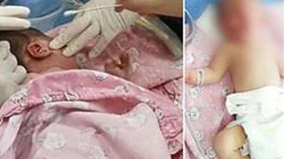 تكرارًا لمسلسل الإهمال.. مصرع طفلة 4 سنوات بسبب 